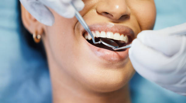 Best Emergency Tooth Extraction in Spearville, KS