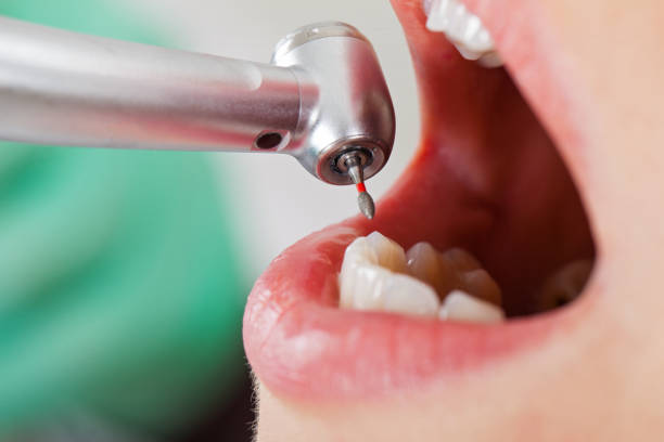 Best Emergency TMJ Treatment in Spearville, KS